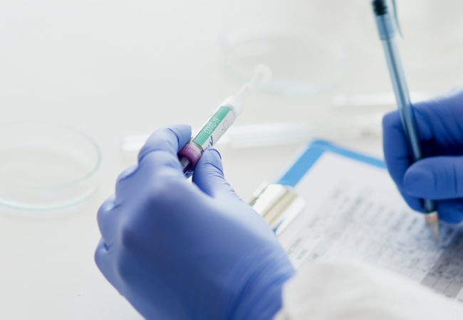 SUS inova na saúde feminina com novo teste de HPV